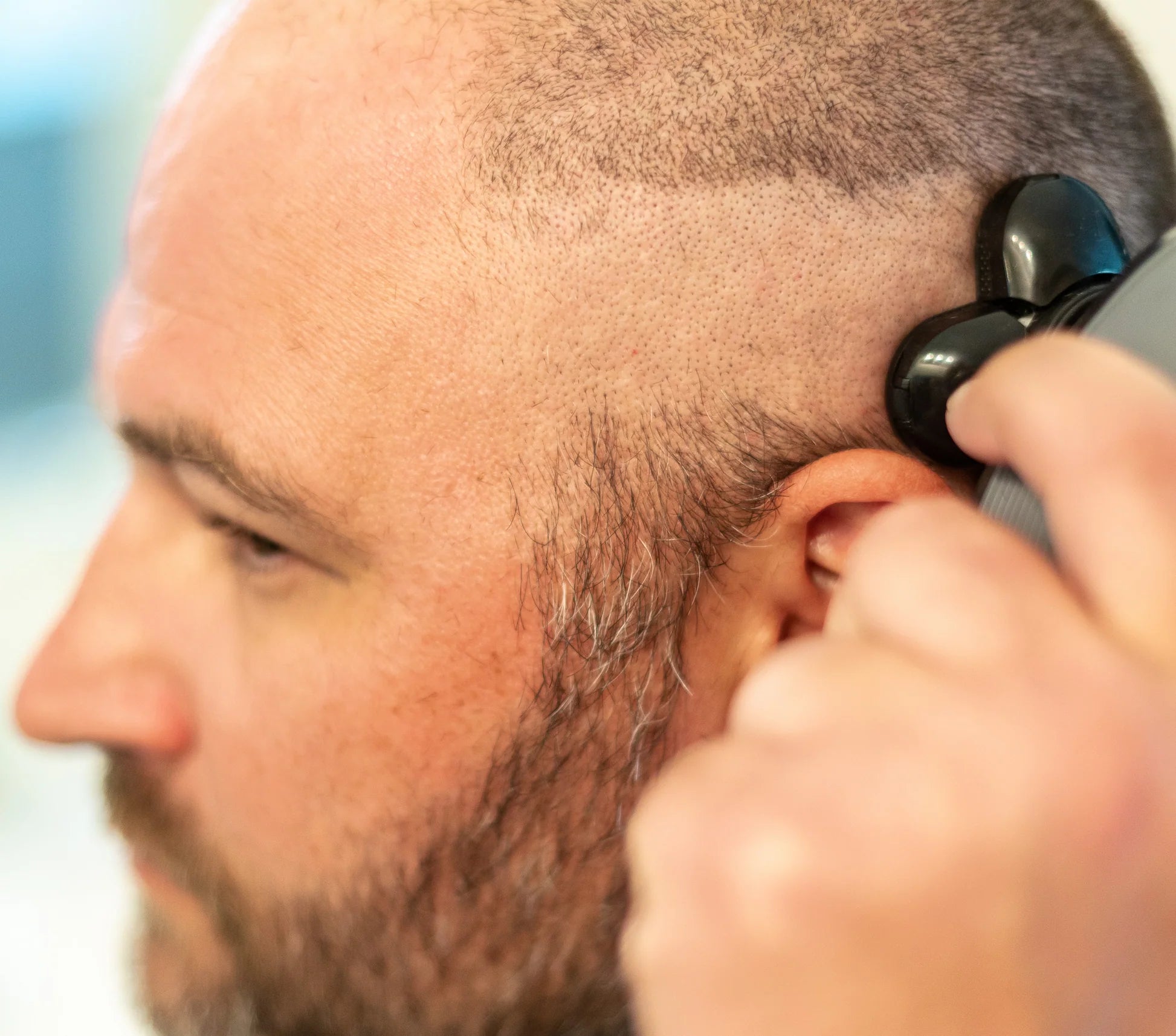 Effortless Head Shaving: Must-Have Shaver For Bald Guys